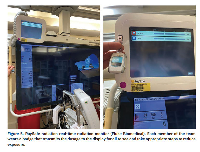 What is the Life Expectancy for Your Lead Apron? Are Your Lab Teams